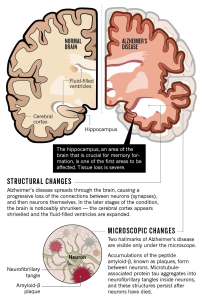 Age-Related Brain Diseases: 17 Modifiable Risk Factors